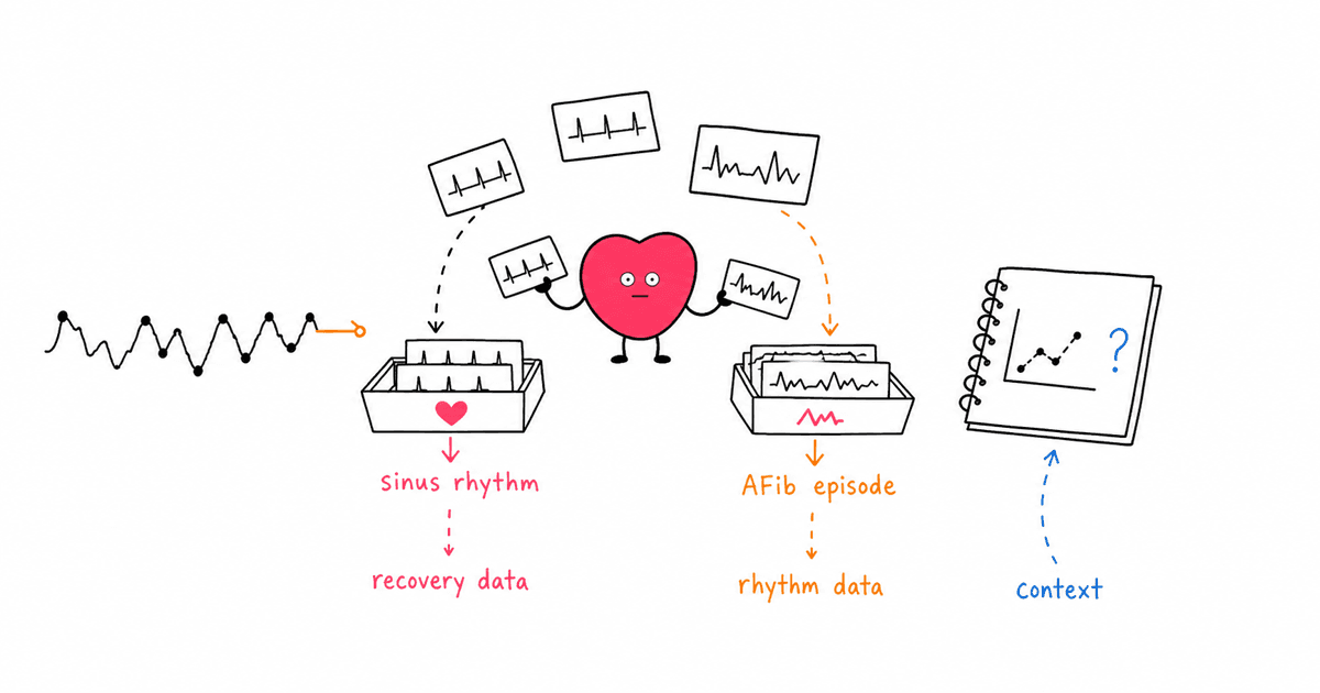 Atrial Fibrillation and HRV: Why Irregular Rhythm Changes the Signal