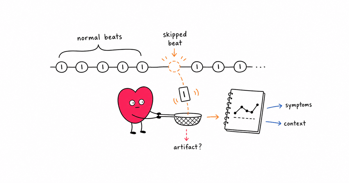 Heart Palpitations and HRV: Why Skipped Beats Can Confuse Your Data